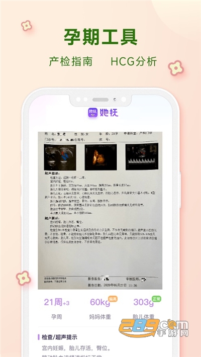 她抚孕育孕期产检助手下载官方appv2.0.0官方版