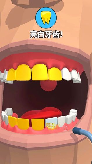 Dentist Bling(拔牙大师官方版) 1.0最新版
