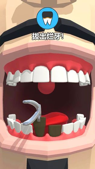 Dentist Bling(拔牙大师官方版) 1.0最新版