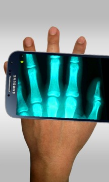 x光扫描仪 Xray scanner
